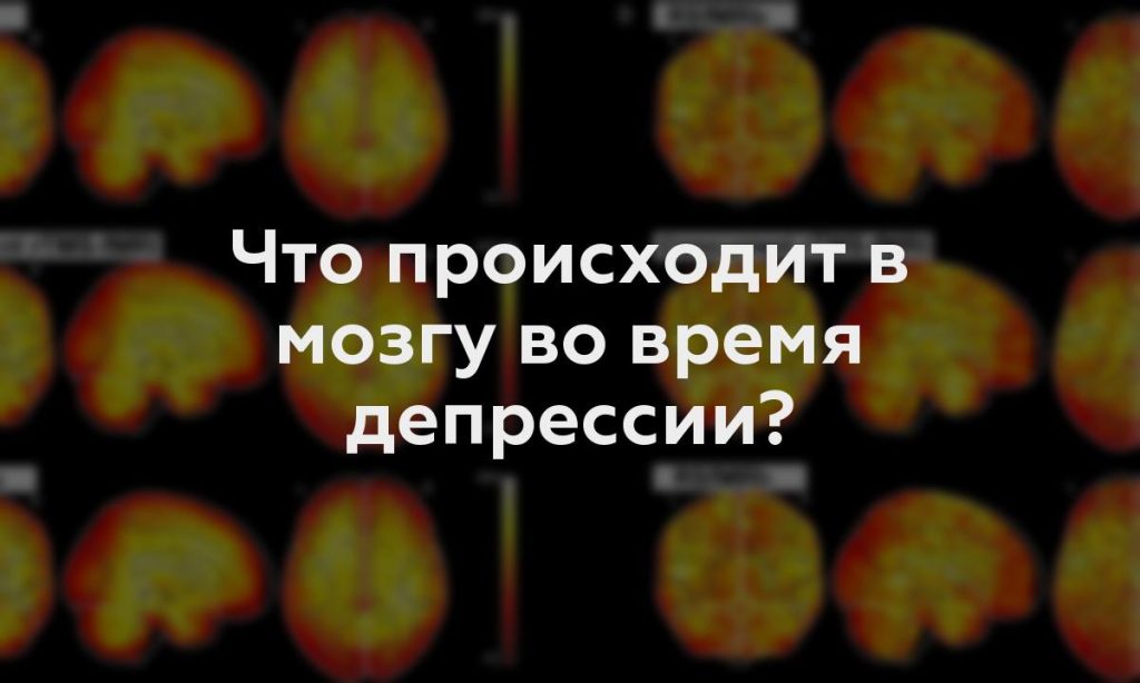 Что происходит в мозгу во время депрессии?