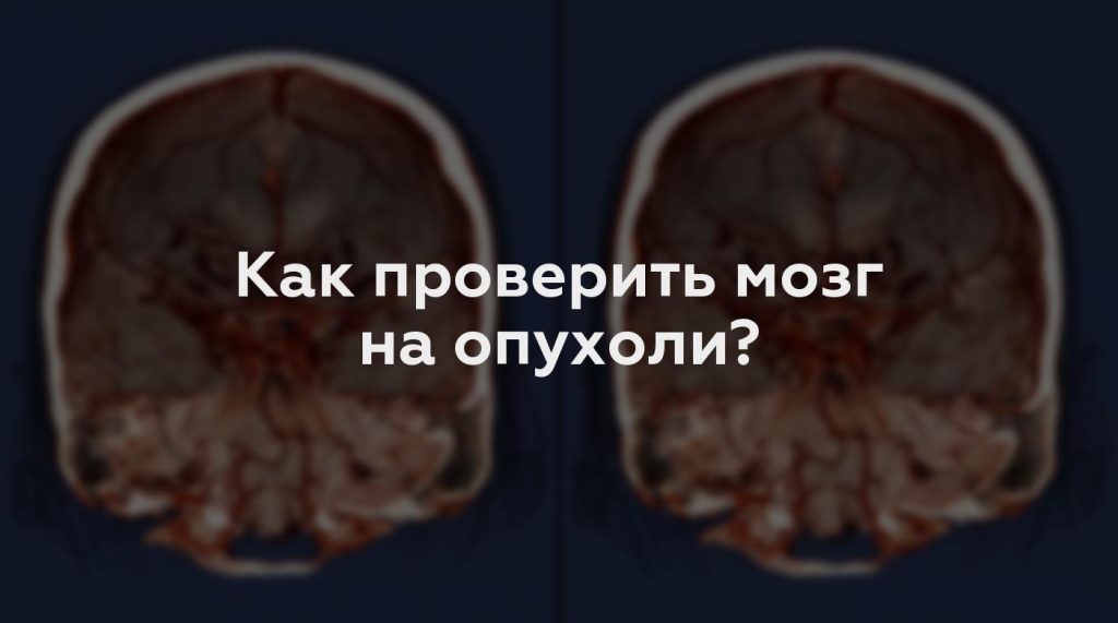 Как проверить мозг на опухоли?